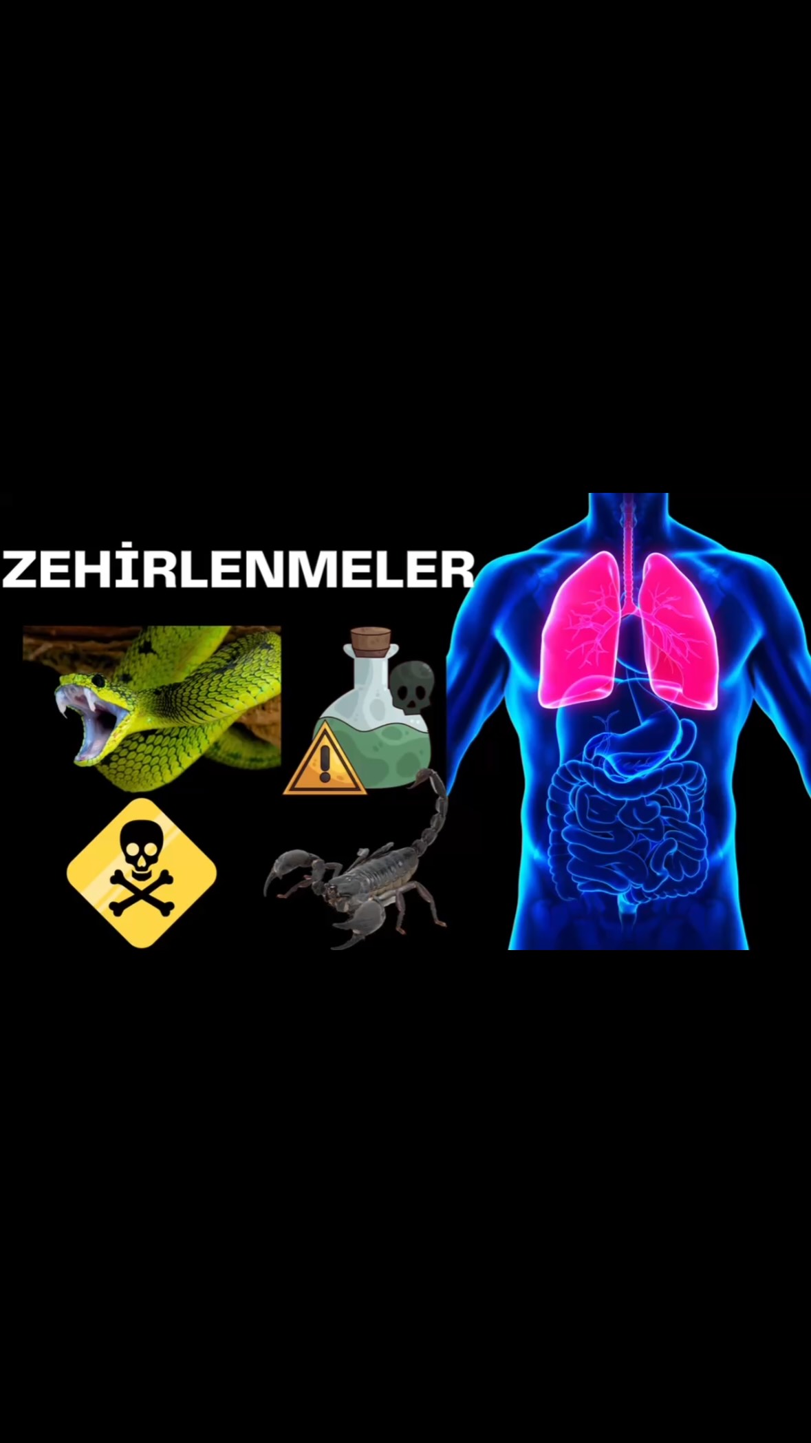 Zehirlenmeler #ehliyetsınavıhazırlık #ankara #ehliyet #turkey #viral
